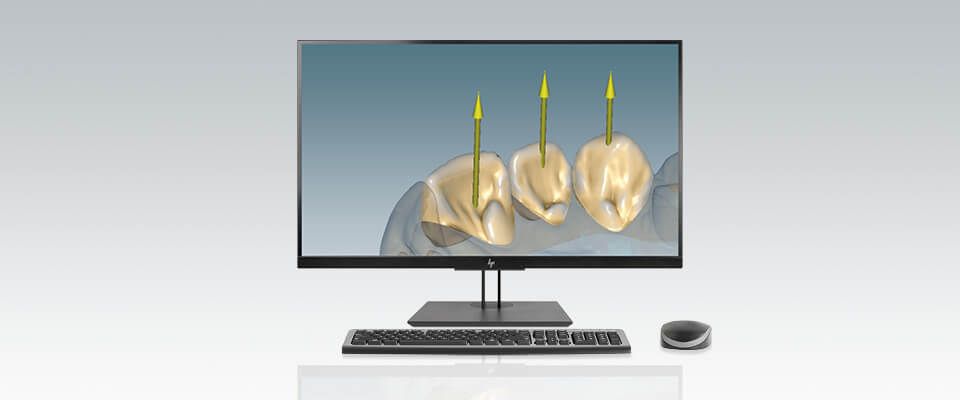 Ceramill Micro Shell logiciel