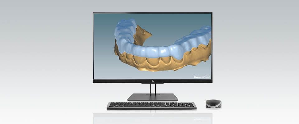 Ceramill M-Splint logiciel