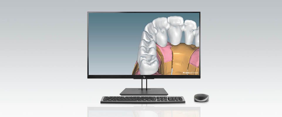 Ceramill M-plant (upgrade Ceramill Mind)